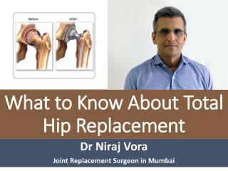 Dr Niraj Vora – About Total Hip Replacement Surgery Procedure| Best Hip Arthroplasty Mumbai