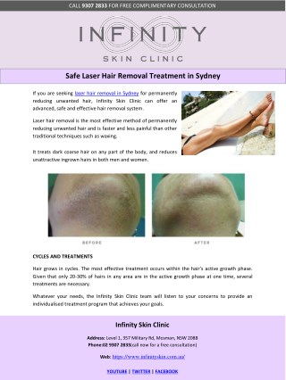 Safe Laser Hair Removal Treatment in Sydney