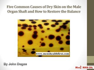 Five Common Causes of Dry Skin on the Male Organ Shaft and How to Restore the Balance