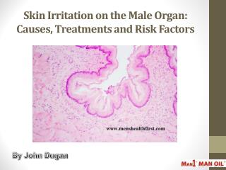 Skin Irritation on the Male Organ: Causes, Treatments and Risk Factors