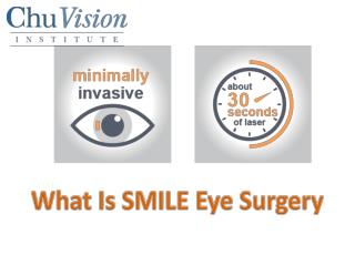 What Is SMILE Eye Surgery