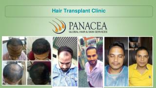 Things To Consider Before Entering into Any Hair Transplant Clinic