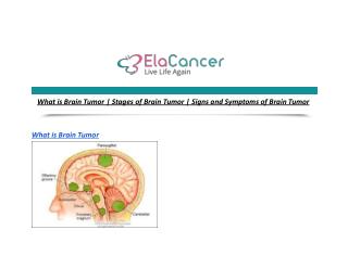 What is Brain Tumor | Stages of Brain Tumor | Signs and Symptoms of Brain Tumor