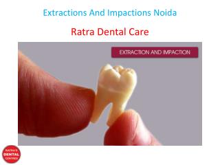 Extractions And Impactions Noida