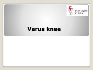 What is Varus Leg | Knee, Hip, Shoulder Replacement | The knee klinik | Sport Injuries