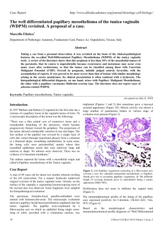 The well differentiated papillary mesothelioma of the tunica vaginalis (WDPM) revisited. A proposal of a case