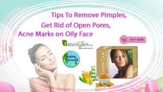 Tips to Remove Pimples, Get Rid of Open Pores, Acne Marks on Oily Face