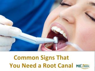 Common signs that you need root canal