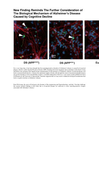 New Finding Reminds The Further Consideration of The Biological Mechanism of Alzheimer’s Disease Caused by Cognitive Dec