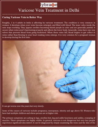 Curing Varicose Vein in Better Way