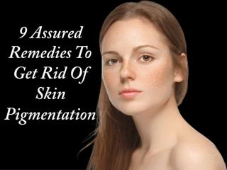 9 Assured Remedies To Get Rid Of Skin Pigmentation