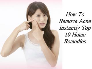 How To Remove Acne Instantly Top 10 Home Remedies