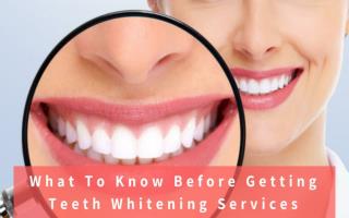 What To Know Before Getting Teeth Whitening Services