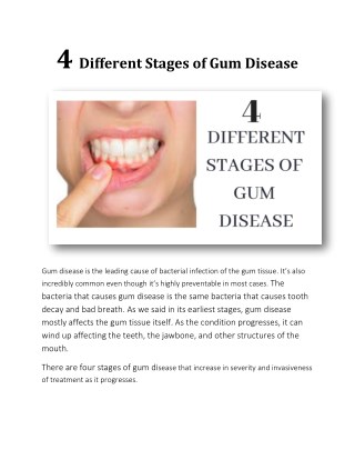 4 Different Stages of Gum Disease