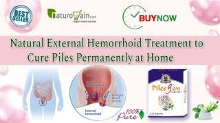 Natural External Hemorrhoid Treatment to Cure Piles Permanently at Home