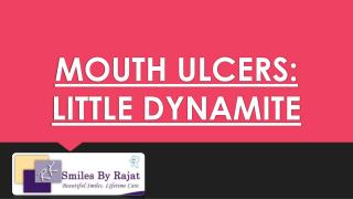 Mouth Ulcers - Dental Implant India