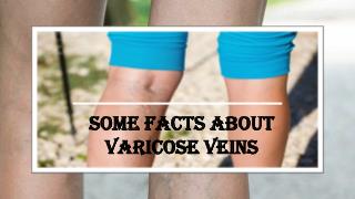 Major Facts Related To Varicose Veins