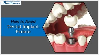 How to Avoid Dental Implant Failure