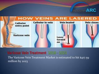 Varicose Vein Treatment Market analysis and growth drivers by 2023