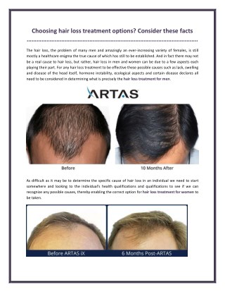 Choosing hair loss treatment options? Consider these facts