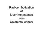 Radioembolization of Liver metastases from Colorectal cancer