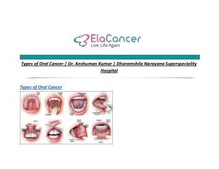 Types of Oral Cancer | Dr. Anshuman Kumar | Dharamshila Narayana Superspeciality Hospital