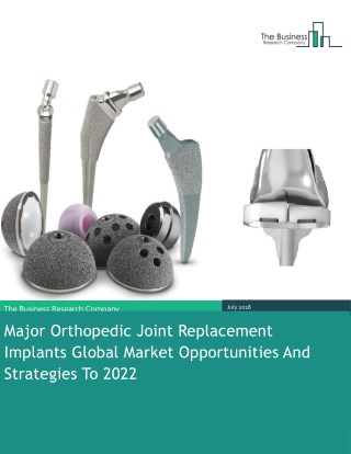 Major Orthopedic Joint Replacement Implants Global Market Opportunities And Strategies To 2022