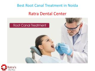 Best Root Canal Treatment in Noida