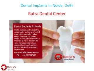 Dental Implants in Noida, Delhi