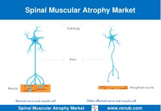 Spinal Muscular Atrophy Market Size