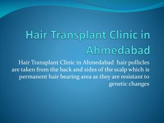 Hair Transplant Clinic in Ahmedabad