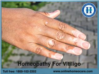 Effective Homeopathy Treatment For Vitiligo