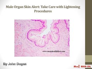 Male Organ Skin Alert: Take Care with Lightening Procedures