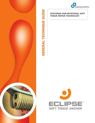 Eclipse™ Soft Tissue Anchor – General Technique Guide