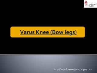 Varus Knee (Bow legs) Deformity Correction| Best knee treatment