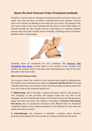Know the best Varicose Veins Treatment methods