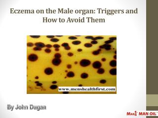 Eczema on the Male organ: Triggers and How to Avoid Them