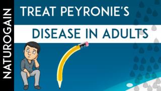 What Is the Best Natural Treatment for Peyronie's Disease in Adults?