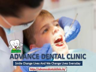 Best Dental Clinic In Delhi