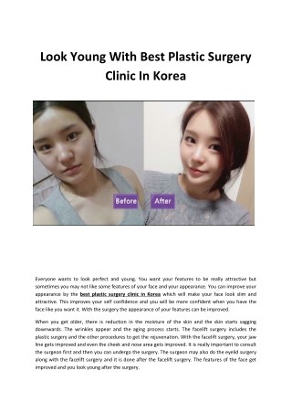 Look Young With Best Plastic Surgery Clinic In Korea