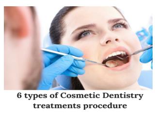 6 Types of Cosmetic Dentistry Procedure for a Confident Smile