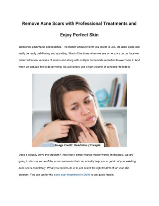 Remove Acne Scars with Professional Treatments and Enjoy Perfect Skin
