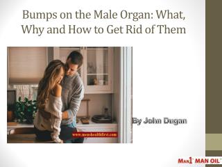 Bumps on the Male Organ: What, Why and How to Get Rid of Them