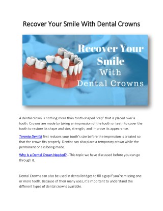 Recover Your Smile With Dental Crowns