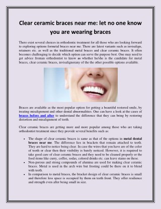 Clear ceramic braces near me let no one know you are wearing braces