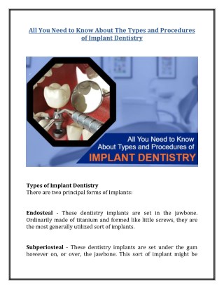 All You Need to Know About The Types and Procedures of Implant Dentistry
