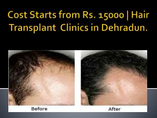 Hair Transplant Clinics, Doctors, Cost in Dehradun | Hair-Transplant-India