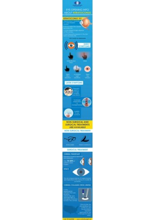 Keratoconus Treatment