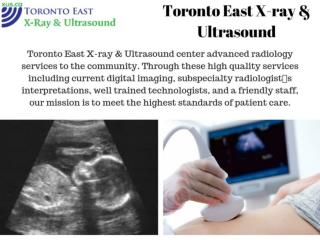 Baby Ultrasound Toronto