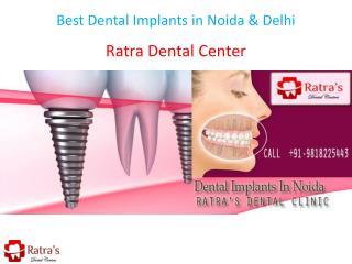 Best Dental Implants in Noida & Delhi